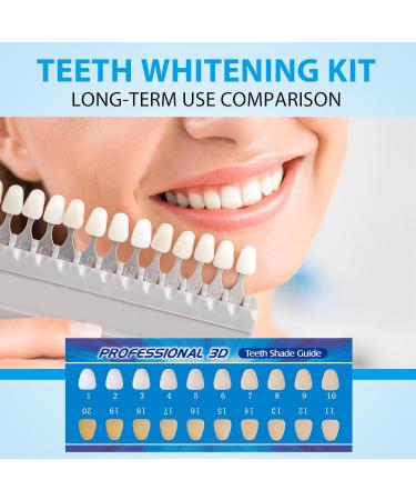 Usmlicer Professional whitening set tooth whitening agent gentle and effective whitening teeth for a whiter smile - Buy Online on GoSupps.com