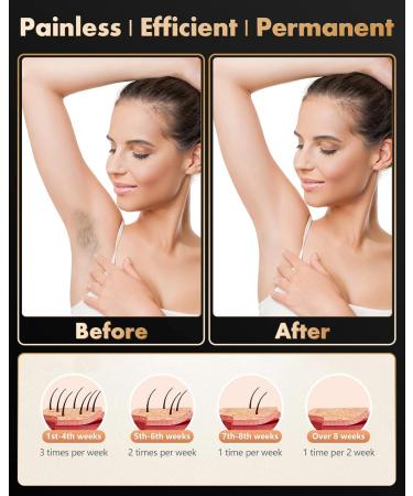 IPL Hair Removal Laser Device for Men & Women - 999 900 Pulses 2 Modes 5 Energy Levels - Painless & Permanent Hair Removal for Body Face & Bikini - Buy Online on GoSupps.com