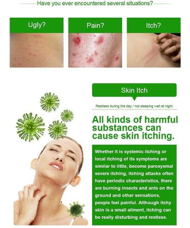 Herbal Anti-Itch Cream Ointment - Soothes Skin, Removes Odor - Buy Online on GoSupps.com