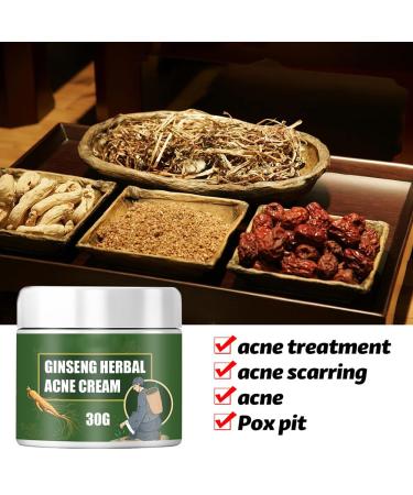 Acne Treatment Cream with 5% Benzoyl Peroxide & Tea Tree Oil - Cystic Acne Spot Treatment for Face - 1.67 oz - Buy Online on GoSupps.com