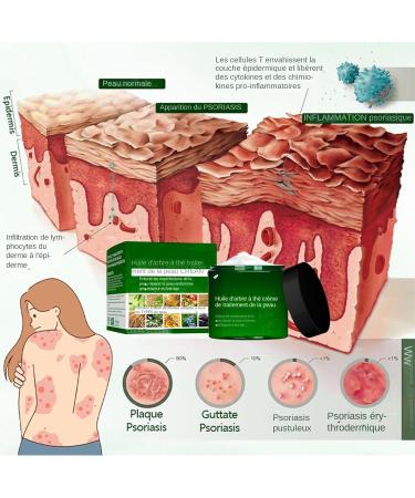  Zasdvn Facial Moisturizer - 50g Non-Greasy Soothing Moisturizing Gel Repairing Facial Care | For Men Women Adults Family Home Travel Beauty Skin Inner - Buy Online on GoSupps.com