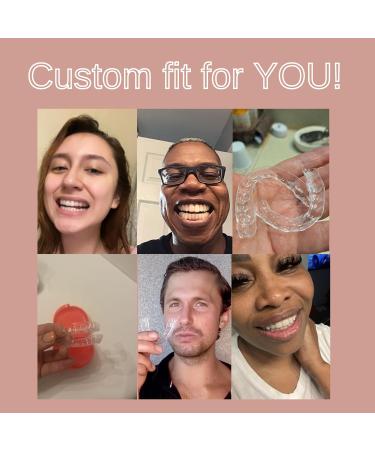 Custom Clear Dental Retainers Kit | Perfect Fit Replacement Upper & Lower Retainers for at Home Use - Buy Online on GoSupps.com
