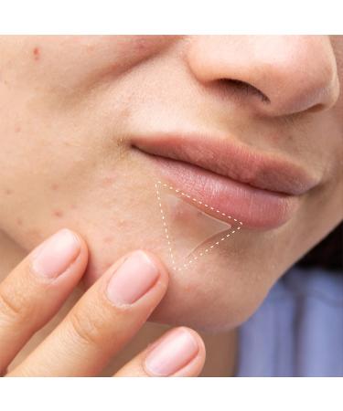 Buy HANHOO Blemish Patch & T-Zone Pore Patch | Hydrocolloid Pimple & Nose Strips | 96 Count for Clear Skin | International Shipping Available - Buy Online on GoSupps.com