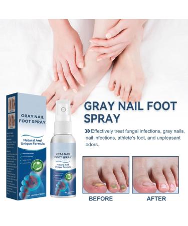 Furzero Nail Fungus & Athlete's Foot Treatment Spray - Medical Grade Anti-Itch Relief (3pcs) - Buy Online on GoSupps.com