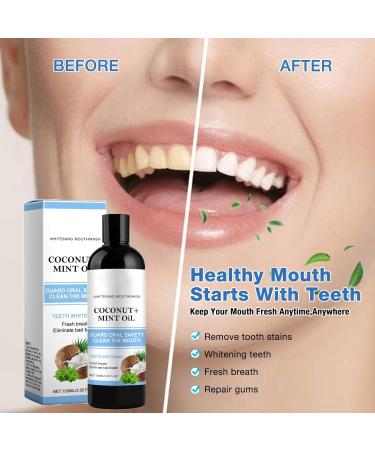 Whitening Oil Mouthwash with Coconut and Peppermint Oil Oil Pulling Mouthwash Oil with Tongue Scraper For Healthy Teeth and Gums Alcohol Free (m 1PC) - Buy Online on GoSupps.com