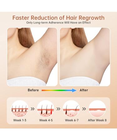 600NM IPL Hair Removal Device - Efficient Laser Epilator for Men & Women | 99900 Flashes & 5 Energy Levels for Home Use - Buy Online on GoSupps.com