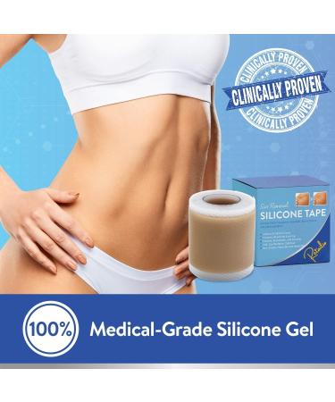Retailio Silicone Scar Sheets - Soften, Flatten Scars, C-Section, Keloid Surgery - Reusable, Washable - 1.6x60 - Buy Online on GoSupps.com