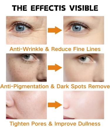 Hydrating Serum - Vitamin C Serum for Face - Hyaluronic Acid Serum for Face - Skin Care Face Serum - Dark Spot Correcting Glow Serum - Anti Aging & Wrinkle Vitamin C Serum - Face Serum for Women - Buy Online on GoSupps.com