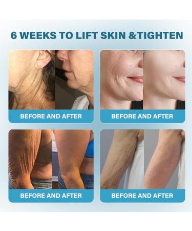 Firm Tighten Skin Cream - Anti-Aging Neck & Body Cream for All Skin Types | Renew Moisture & Lift Firmness - Buy Online on GoSupps.com