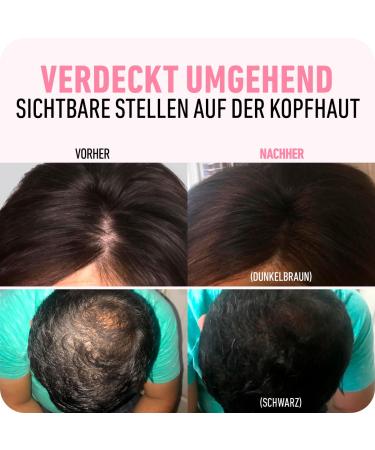 Boldify Approach Powder | Instant Scatter Hair Repair for Thinning & Gray Roots | 48-Hour Formula | Copper Brown 10g - Spread-Free Hair Solution - Buy Online on GoSupps.com