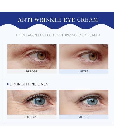 Moisturizing Collagen Peptides Eye Cream Dark Circle Eye Cream Anti Wrinkle Eye Cream With Hydrolyzed Collagen To Reduce Puffiness Crows Feet And Eye Bags Caffeine Eye Cream All Skin Types - Buy Online on GoSupps.com