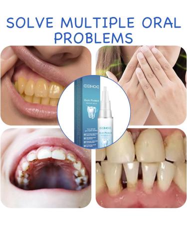 Ninnyi Teeth Whitening Essence Pen Gum Shield Therapy Gel with a Soft Toothbrush Kit - Buy Online on GoSupps.com
