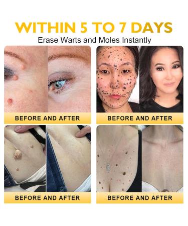 Daasry Bee Venom Skin Restoration Cream Bee Venom Skin Treatment Cream Bee Venom Wrinkle Removal cream for All skin Types (1) - Buy Online on GoSupps.com