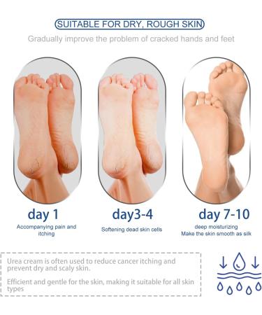 42% Urea Cream Urea Foot & Hand Cream for Dry Cracked Callus and Dead Skin Remover Foot Moisturizing Stick for Foot Care Cracked Heel Treatment Knees Elbows Hands Repair Feet Lotion - Buy Online on GoSupps.com