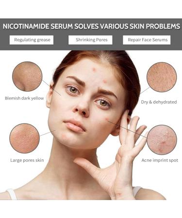 Retinoid 2% Emulsion Retinol Serum Facial Moisturiser for Women Retinol Anti-Aging Face Serum Retinol Serum for Face Hydrating Serum Anti Wrinkle Serum Fade Fine Lines Hydrating Moisturiser for Face - Buy Online on GoSupps.com