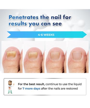 Extra Strength Toenail Fungus Treatment - Fast Acting Home Solution for Healthy Nails | Repair & Renew Damaged Toenails in One Week - Buy Online on GoSupps.com