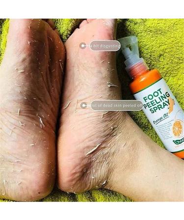 Foot Peeling Spray Orange Oil Exfoliating Foot Moisturizing Hydrating Nourish Peel Off Spray Remove Dead Skin And Calluses On Feet Gentle Foot Care. (Green Tea) - Buy Online on GoSupps.com