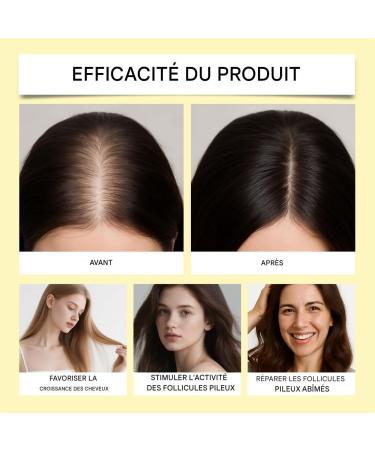 Oil for Dry Hair | Moisturizing with Scalp Massage | 100ml Nourishing and Repairing Oil Set - For Curly Frizzy Long Fine Straight Hair with Split Ends Men and Women - Buy Online on GoSupps.com