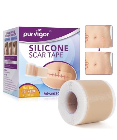 Silicone Scar Sheets Silicone scar Strips Reusable silicone Scar Tape Roll for C-section & Surgery Burns Acen scars Stretch Marks Keloid et (1.6 x 120 Roll-3M)