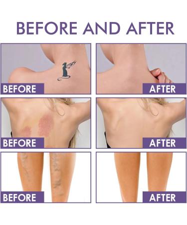 Orgrul 3 Pieces Covering Cream for Broom Travel 74ml Waterproof Leg Makeup Without Transfer Leg Makeup Concealer Cream Camouflage Makeup Waterproof Cover Varicose Veins - Buy Online on GoSupps.com