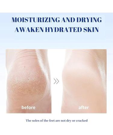 Cracked Heel Care Foot Moisturizer Cream Rapid Absorption Intense Hydration Healing Callus Softener Ideal for Rough Skin Pedicure Nighttime Repair Routine - Buy Online on GoSupps.com