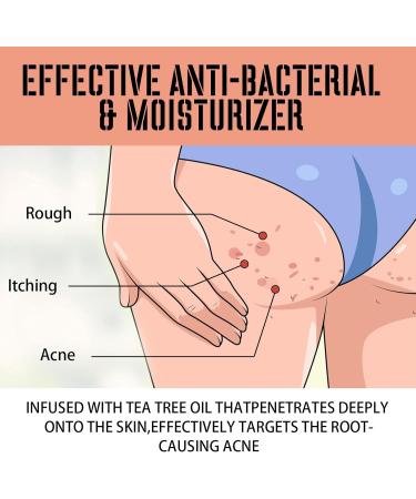  Mnozreo Acne Cream for Blemishes on the Hips 100ml 1pc (Acne Cleanser for Hips Removal of Blemishes) 2-3 Times a Day - Buy Online on GoSupps.com