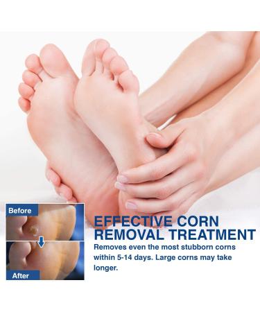 TXL Active Feet Corn Remover 30 Pack - Fast & Easy Toe Corn Removal with Cushioning Protection - One Step Corn Removers for Feet and Toes - Buy Online on GoSupps.com