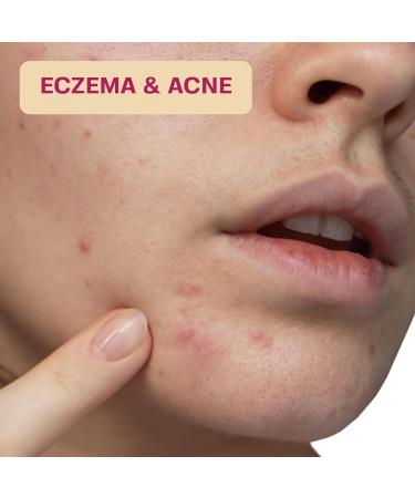 BASE LABORATORIES Hypochlorous Acid Wipes - Saline Solution Skin & Face Cleansing Wipes | Soothes Irritations Acne & Eczema | 75 Wipes Pack - Buy Online on GoSupps.com