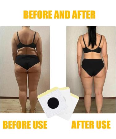 30-Piece Fast Fat Burner Plaster - Accelerate Metabolism & Detox for Waist & Belly Fat Reduction - Buy Online on GoSupps.com