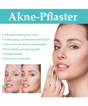 Fonyiunce 300 pieces pimples for daily and evening use invisible hydrocolloid acne patches with tea oil and salicylic acid can eliminate acne quickly - Buy Online on GoSupps.com