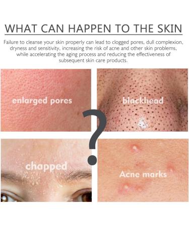 Azelaic Acid Suspension 10% Face Serum Azelaic Acid Serum Cream with Niacinamide & Vitamin C Anti Acne Cream Face Serum for Women Hydrating Serums Skincare to Reduces Blackheads Anti Aging Serum - Buy Online on GoSupps.com