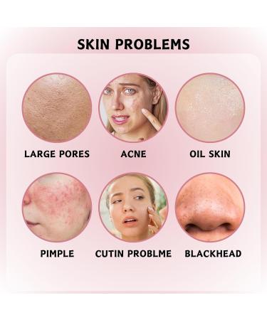 Face Masks Beauty - Natural Rose Jelly Mask - Jelly Face Mask for Skin Care - Face Masks Skincare - Hydrating Face Mask - Peel Off Face Masks - Deep Cleansing Hydrating - Reduces Acne and Pores - Buy Online on GoSupps.com