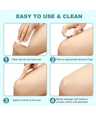 BESTEK Scar Cream - Advanced Scar Gel for Surgical Acne Keloids & Stretch Marks - Effective Scar Treatment for Face & Body - 1.76oz/50ml - Buy Online on GoSupps.com
