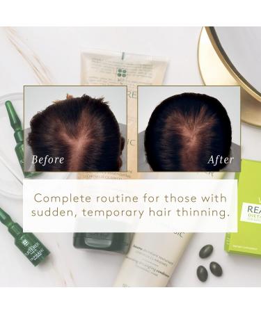 Rene Furterer Reactional Thinning Hair Ritual - Drug-Free Solution for Sudden Thinning Hair | International Shipping - Buy Online on GoSupps.com