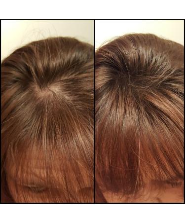 Caboki VALUE PACK 2 270-Day Supply Auburn - Buy Online on GoSupps.com