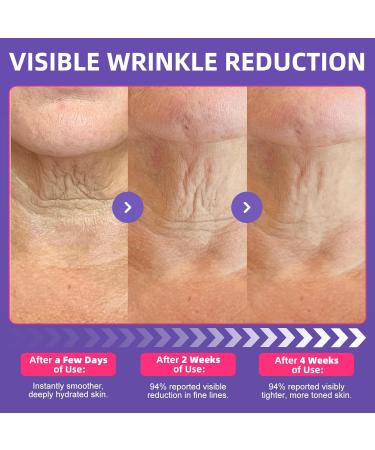 Neck Firming Cream with Roller Neck Cream for Tightening and Firming with Retinol Collagen & Niacinamide to Reduce Wrinkles Tighten Sagging Skin & Lift Jawline Retinol Firming Neck Cream - Buy Online on GoSupps.com