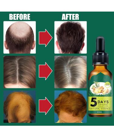 Shantou Yingji 2 pieces ginger hair growth oil ginger hair growth essential oil ginger hair treatment oil solution for hair growth essential oil against hair loss 2 pieces x 30 ml hair2 pieces - Buy Online on GoSupps.com