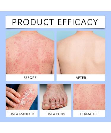  CGACCSD Skin Soothing Spray | 50ml Moisturizing & Soothing Mist For Dry Skin | Repair Care For Women Men Sensitive Oily Redness Tears | Daily Use Winter Travel - Buy Online on GoSupps.com