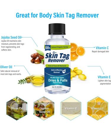 Skin-Tag-Remove-Kit-Skin-Tag-Remover Wart&Mole-Remover Serum Fast-Acting and Effect Blue 30ML Original - Buy Online on GoSupps.com
