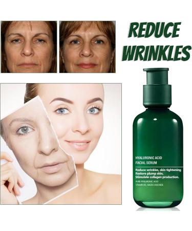 Hyaluronic Acid Facial Serum Hyaluronic Acid Serum Anti Wrinkle Serum Dark Spot Remover for Face Hyaluronic Acid Face Serum for Women Face Moisturiser Skin Tightening Hydrating Plump Skin - Buy Online on GoSupps.com
