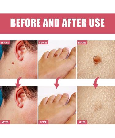 KOAHDE Rose Oil Soap Natural Extract Soap Gentle Safe Suitable for All Skin Types 80G - Buy Online on GoSupps.com