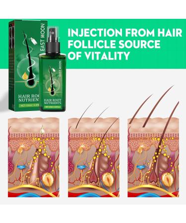 Accelerate Hair Growth Serum | Anti-Hair Loss for Men & Women | Promotes Thicker Fuller Hair - Buy Online on GoSupps.com