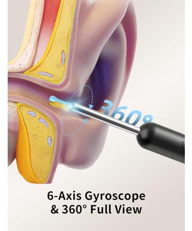 Hopefox Ear Wax Removal Kit Camera | 1080P WiFi Visual Ear Cleaner with Ear Pick Set | 6 LED Earwax Remover for iPhones & Android Phones - Buy Online on GoSupps.com