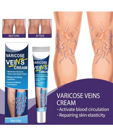 Varicose Vein Cream 20g - Pain Relief & Spider Veins Repair - Buy Online on GoSupps.com