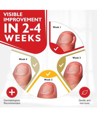 Professional Ingrown Toenail Treatment Drops | Easy Trimming & Softening | Pin Reduction | 30ml - Buy Online on GoSupps.com