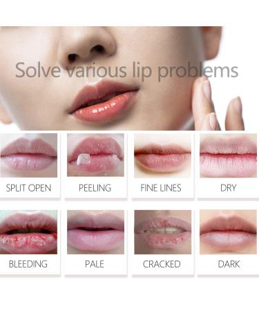 30 Collagen Crystal Lip Masks - Nourishing Gel Pads for Dry Cracked Lips | Anti-Aging & Repair Treatment - Buy Online on GoSupps.com