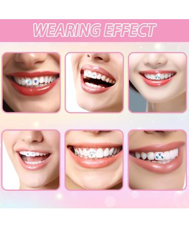 Shop IJHYGD Tooth Jewelry Set - Premium Tooth Gems Kit with Glue | Perfect Tartar Jewelry for Stunning Smiles - Buy Online on GoSupps.com