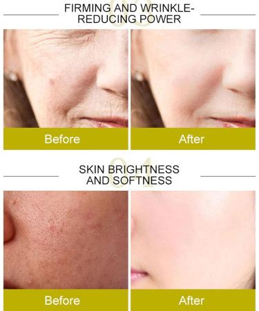 Turmeric Oil for Dark Spots | Natural Repair Essence | Non-Fatty Essential Oil for Skin & Massage | Geruwam - Buy Online on GoSupps.com