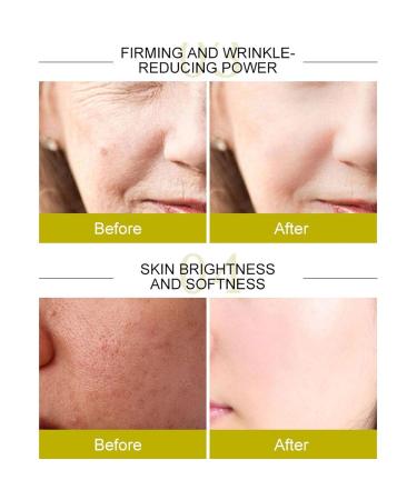 Turmeric Oil - Repair Facial Essential Oil | Natural Non-Fat Oil for Skin Face & Body Massage | Highyee - Buy Online on GoSupps.com