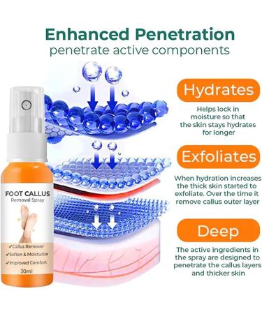 2PC Foot Callus Removal Spray - Instant Dead Skin & Callus Peeling with Orange Oil - 30ml - Fast International Shipping - Buy Online on GoSupps.com